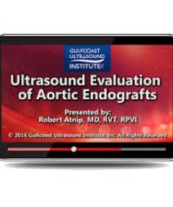 Ultrasound Evaluation of Aortic Endografts