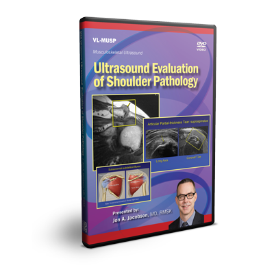 Ultrasound Evaluation of Shoulder Pathology