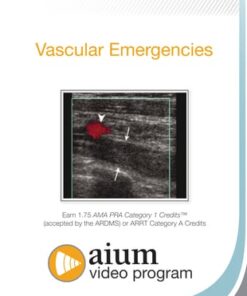 Ultrasound Evaluation of Vascular Emergencies