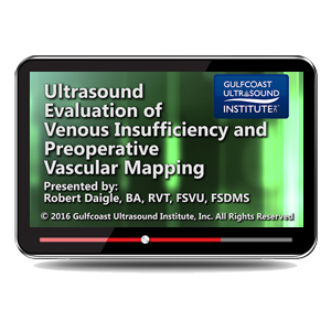 Ultrasound Evaluation of Venous Insufficiency and Preoperative Vascular Mapping
