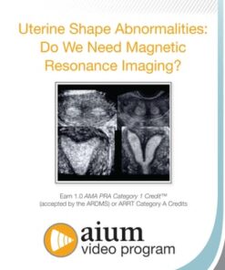 Uterine Shape Abnormalities: Do We Need Magnetic Resonance Imaging?