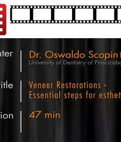 Veneer Restorations – Essential Step For Esthetic Success (Video)