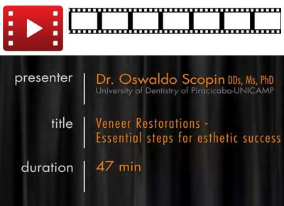 Veneer Restorations – Essential Step For Esthetic Success (Video)