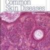 Common Skin Diseases 18th