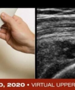 Fundamentals of Musculoskeletal Ultrasound 2020