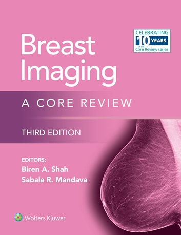 Breast Imaging (EPUB)