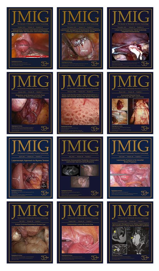 Journal of Minimally Invasive Gynecology 2021 Full Archives (True PDF)