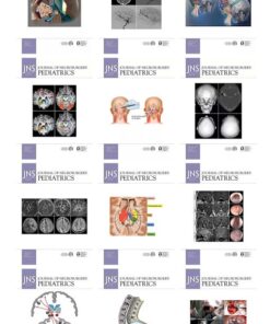 Journal of Neurosurgery: Pediatrics 2022 Full Archives (True PDF)