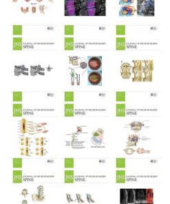 Journal of Neurosurgery: Spine 2022 Full Archives (True PDF)