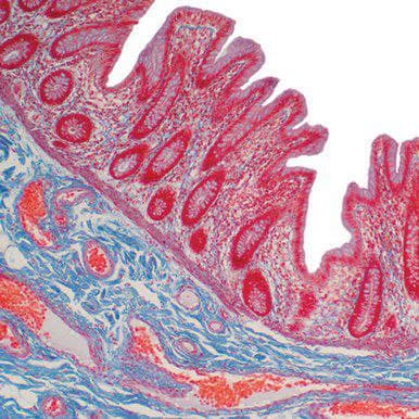 Current Topics in Gastrointestinal and Liver Pathology 2022 CME VIDEOS