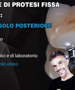 Corso Base di Protesi Fissa su Impianti, Il Dente Singolo Posteriore