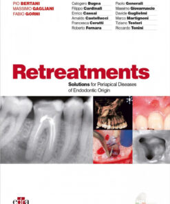 Retreatments: Solutions for Periapical Diseases of Endodontic Origin PDF