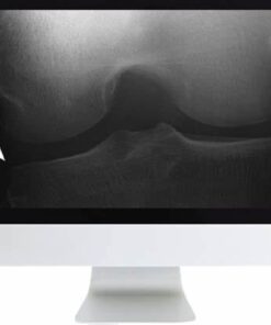 Musculoskeletal Imaging for the Practicing Radiologist