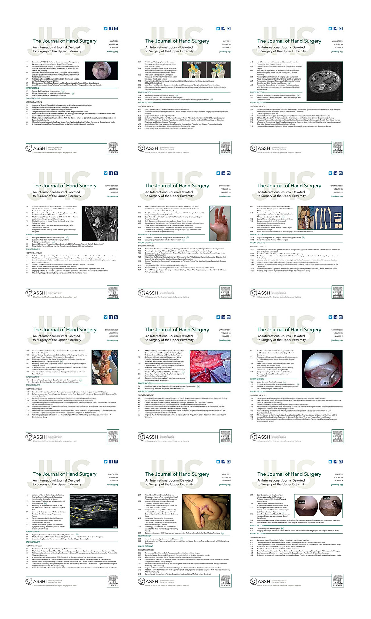 The Journal of Hand Surgery 2021 Full Archives (True PDF)