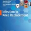 Infection in Knee Replacement 2022 Original pdf Infection in Knee Replacement 2022 Original pdf