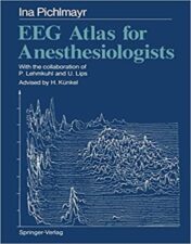 EEG Atlas for Anesthesiologists 1978 Original PDF