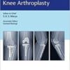 Complex Primary Total Knee Arthroplasty 2017 Original PDF