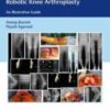 Computer Navigated and Handheld Robotic Knee Arthroplasty: An Illustrative Guide 2021 Original PDF