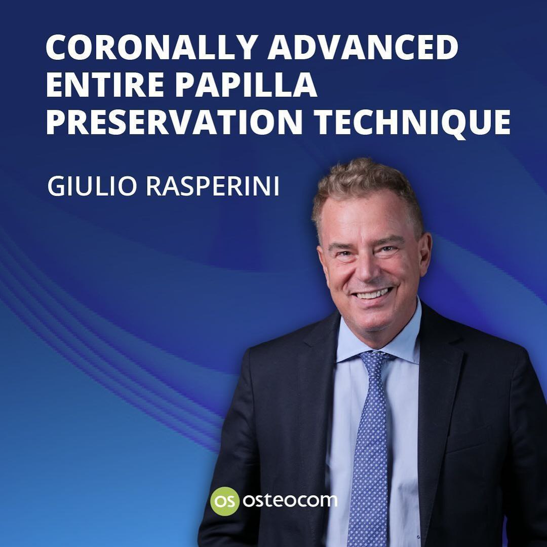 Osteocom - Coronally Advanced Entire Papilla Preservation Technique - Giulio Rasperini