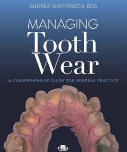 Managing Tooth Wear: A Comprehensive Guide For General Practice 2023