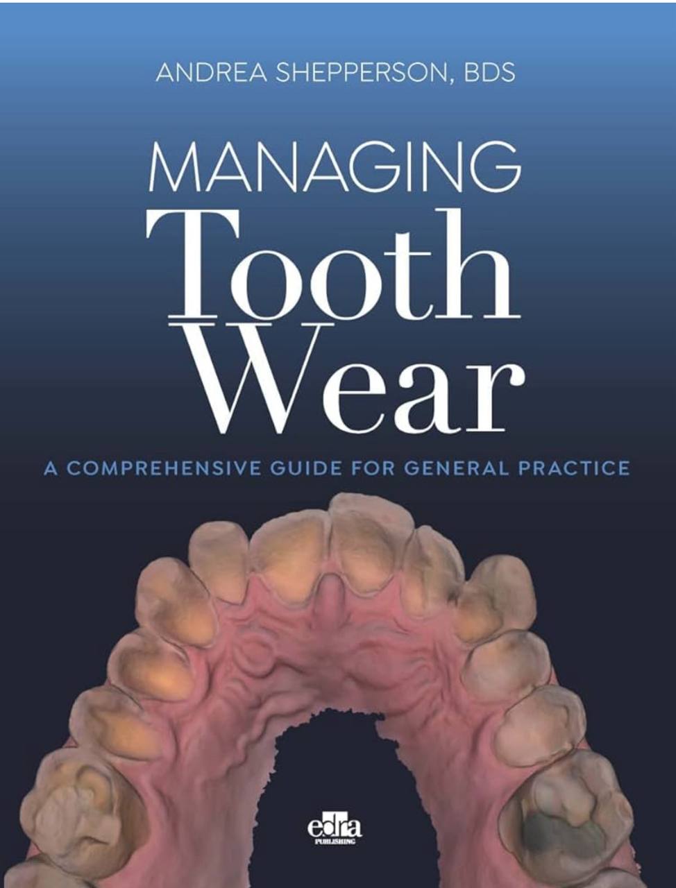Managing Tooth Wear: A Comprehensive Guide For General Practice 2023
