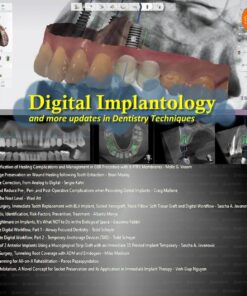 gIDE Digital Implantology and more Updated in Dentistry Techniques