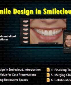 Spear Smile Design in Smilecloud: