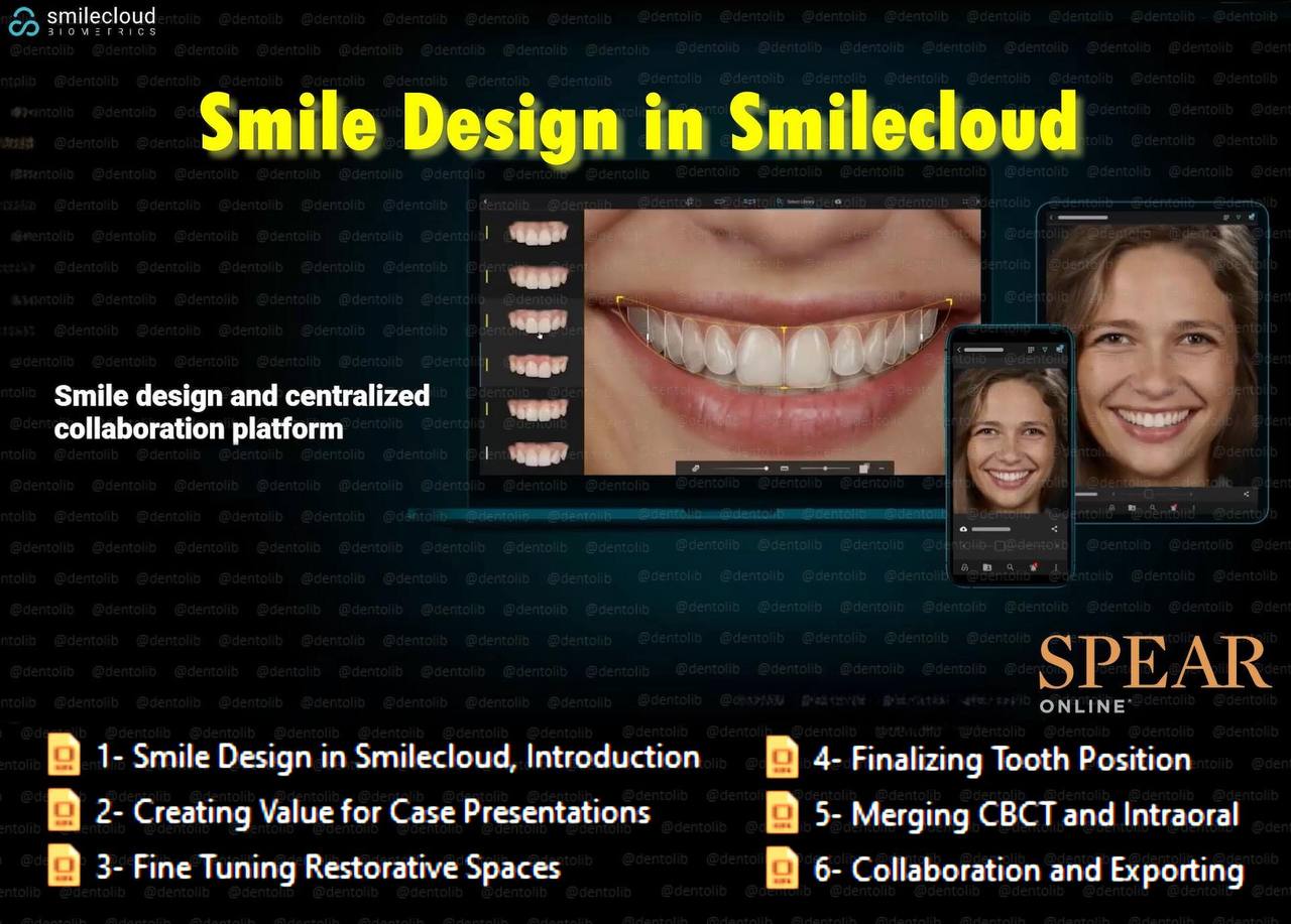 Spear Smile Design in Smilecloud: