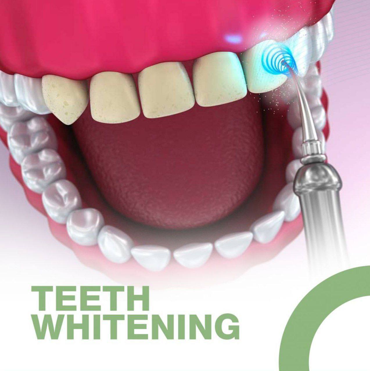 Teeth Whitening and Cosmetic Dentistry