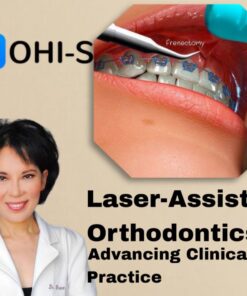 OHI-S- Laser-Assisted Orthodontics: Advancing Clinical Practice