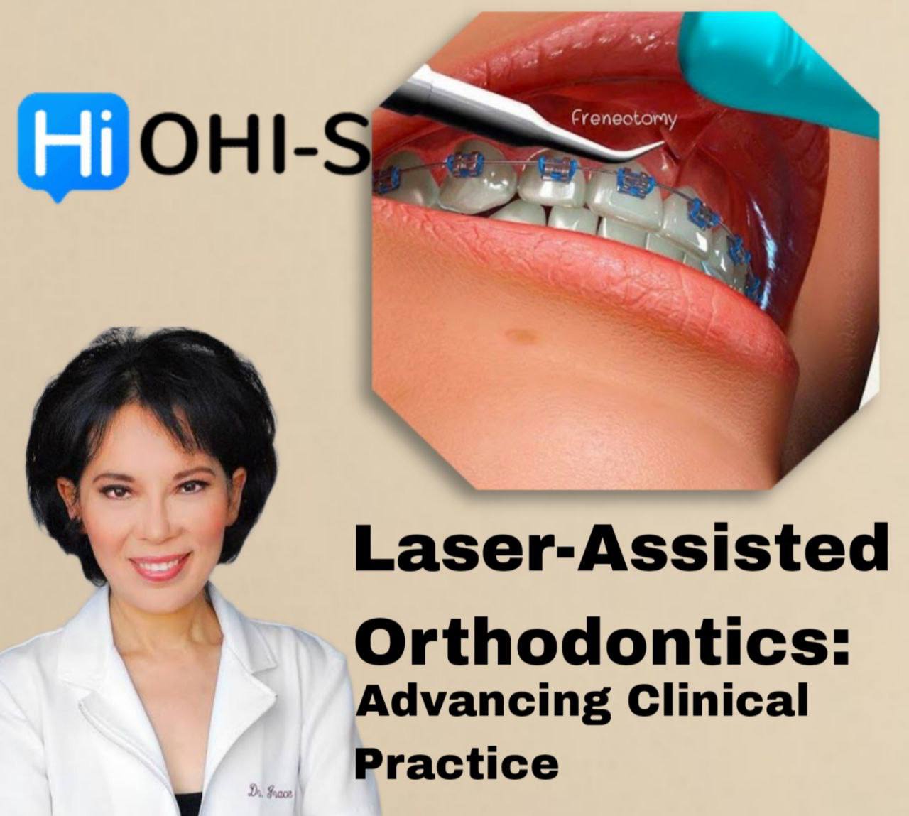 OHI-S- Laser-Assisted Orthodontics: Advancing Clinical Practice