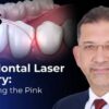OHI-S – Laser Periodontology: Optimizing the Pink Aesthetic